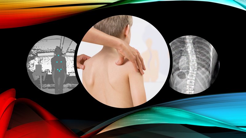 Diagnose Scoliosis