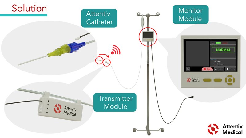 The Attentiv Catheter