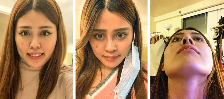 18 человек рассказали, чем обернулась для них пластика, о которой они так мечтали