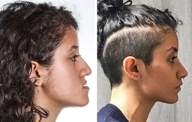 18 человек рассказали, чем обернулась для них пластика, о которой они так мечтали