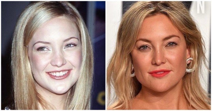 Как изменились 14 популярных актеров и актрис, от которых все были без ума. А некоторые до сих пор в любимчиках