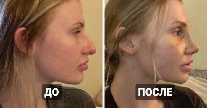 Люди, которые сделали пластическую операцию и почувствовали себя счастливее Люди, которые сделали пластическую операцию и почувствовали себя счастливее