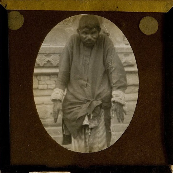 Фотография: Самые известные дети-маугли: Как сложились судьбы малышей, которые выросли среди животных №10 - BigPicture.ru