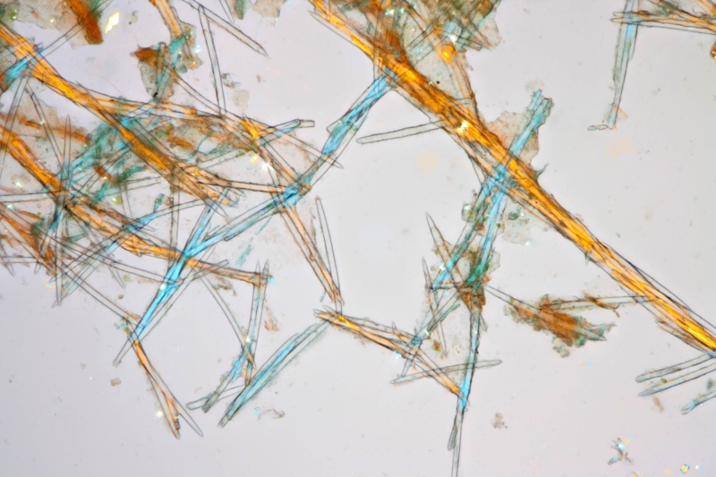 Фотография: Бадяга: она спасает тебя от синяков, а ты даже не знаешь, что это не растение №4 - BigPicture.ru