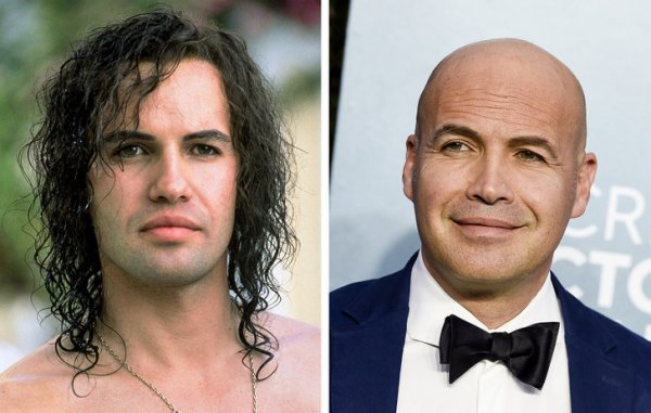 Знаменитые мужчины до того, как стали лысыми