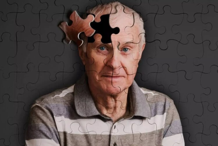 Распространенные последствия инсульта. Нарушение памяти — одно из главных последствий инсульта. Фото.