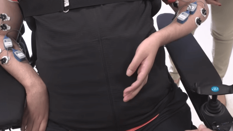 Как работают импланты на основе искусственного интеллекта. Электроды, закрепленные на руках и позвоночнике, позволяют совершать движения руками парализованному человеку. Как работают импланты на основе искусственного интеллекта. Электроды, закрепленные на руках и позвоночнике, позволяют совершать движения руками парализованному человеку. Фото.