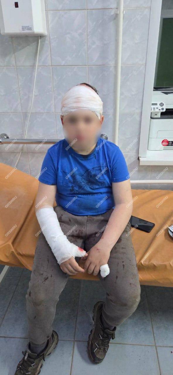 Под Орском огромный бродячий алабай попытался отгрызть голову школьнику