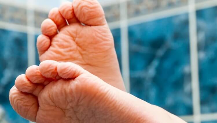 Почему морщины формируются одинаково? Новое открытие может использоваться в судебной медицине при идентификации тел. Источник: www.bbc.com. Фото.