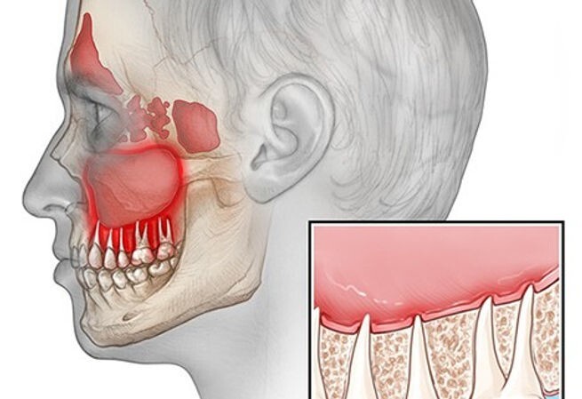 6. Обманчивая боль 6. Обманчивая боль