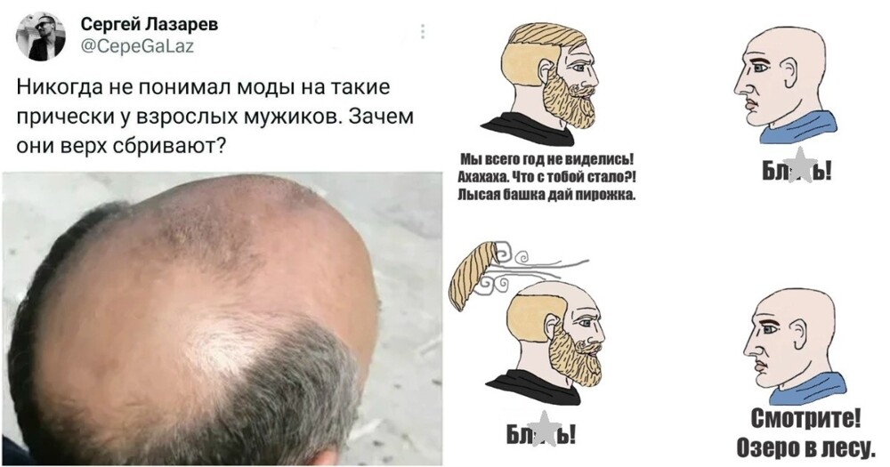 Облысению конец? Тайваньские учёные создали уникальную сыворотку