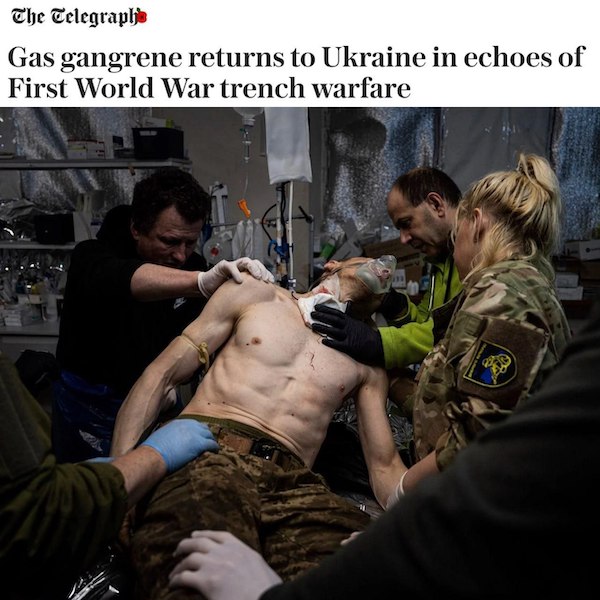 Газовая гангрена: смертельная инфекция косит боевиков ВСУ