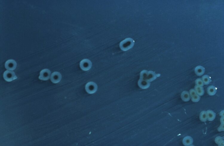 Что такое брюшной тиф. Колония возбудителей брюшного тифа, Источник изображения: wikipedia.org. Фото.